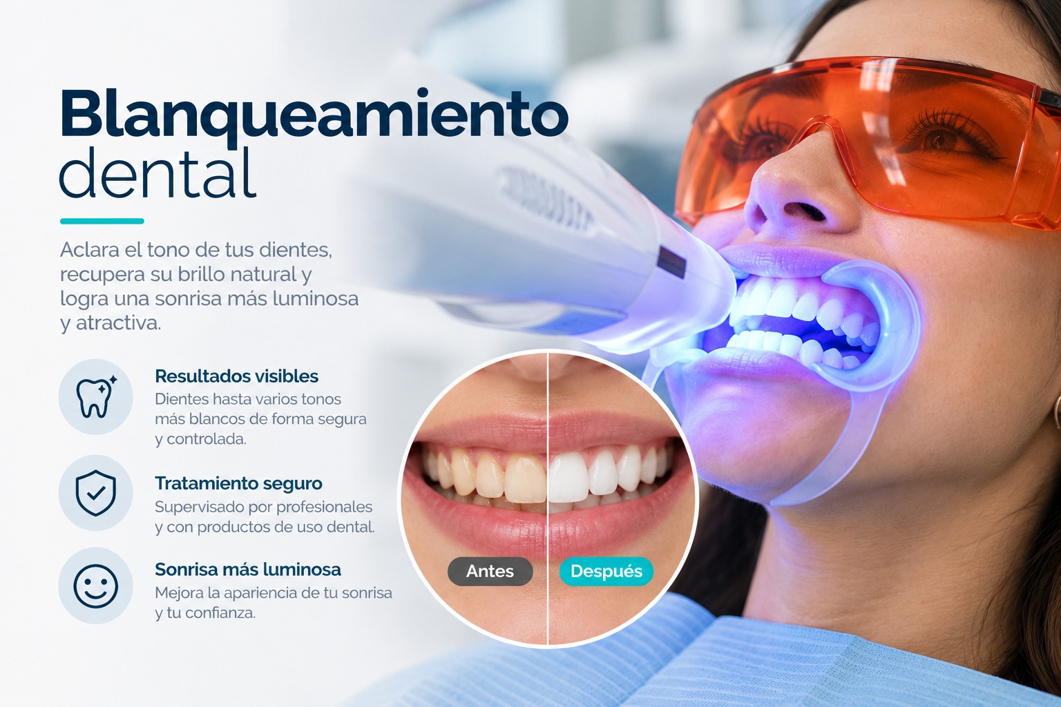 Blanqueamiento dental - Orto Art